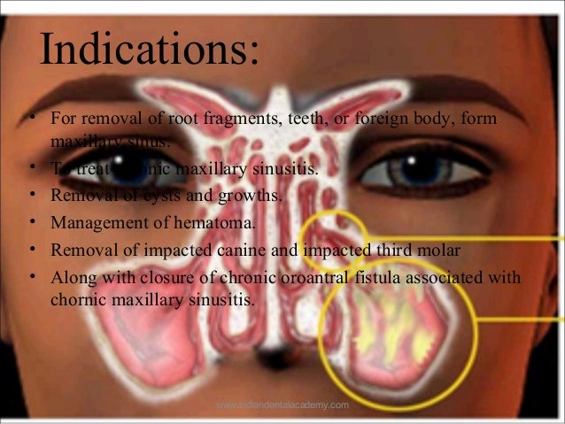 facial sinus cyst Casey dellacqua sexy pics